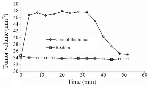 https://cdn.ncbi.nlm.nih.gov/pmc/blobs/7127/3833863/1ac47dacc1f0/OL-06-06-1550-g09.jpg