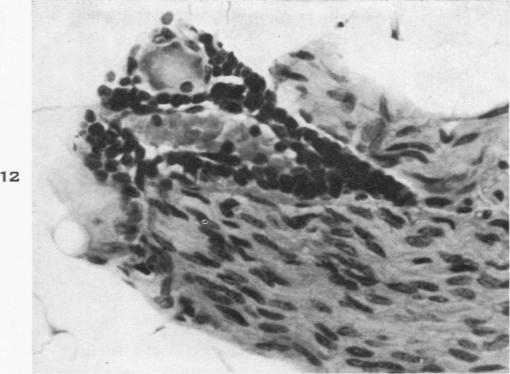 https://cdn.ncbi.nlm.nih.gov/pmc/blobs/712a/1942474/93bf0bc3e834/amjpathol00702-0160-a.jpg