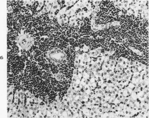https://cdn.ncbi.nlm.nih.gov/pmc/blobs/712a/1942474/d19429104683/amjpathol00702-0156-a.jpg