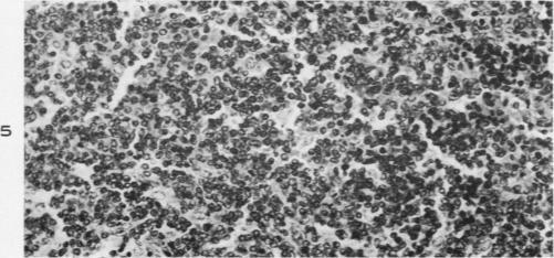 https://cdn.ncbi.nlm.nih.gov/pmc/blobs/712a/1942474/f2d39c3afabc/amjpathol00702-0155-b.jpg