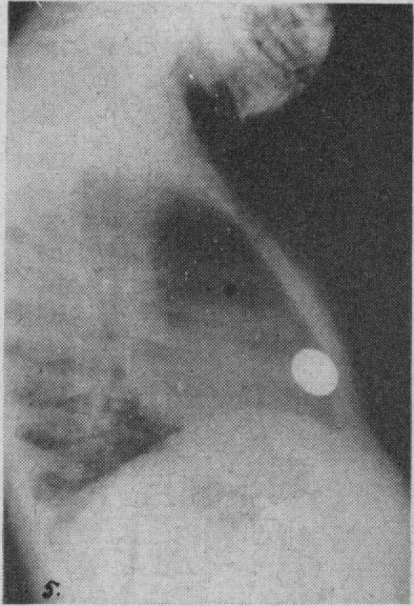 https://cdn.ncbi.nlm.nih.gov/pmc/blobs/7133/1821660/1ace8b459061/canmedaj00653-0038-a.jpg