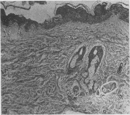 https://cdn.ncbi.nlm.nih.gov/pmc/blobs/7133/1821660/bf2d90f7ca9f/canmedaj00653-0037-c.jpg