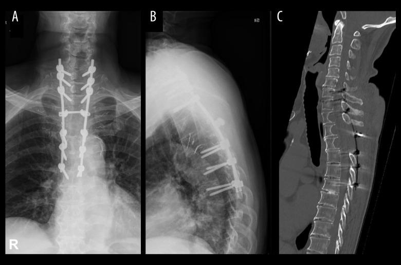 https://cdn.ncbi.nlm.nih.gov/pmc/blobs/7137/10009649/633d5996f251/amjcaserep-24-e939368-g005.jpg