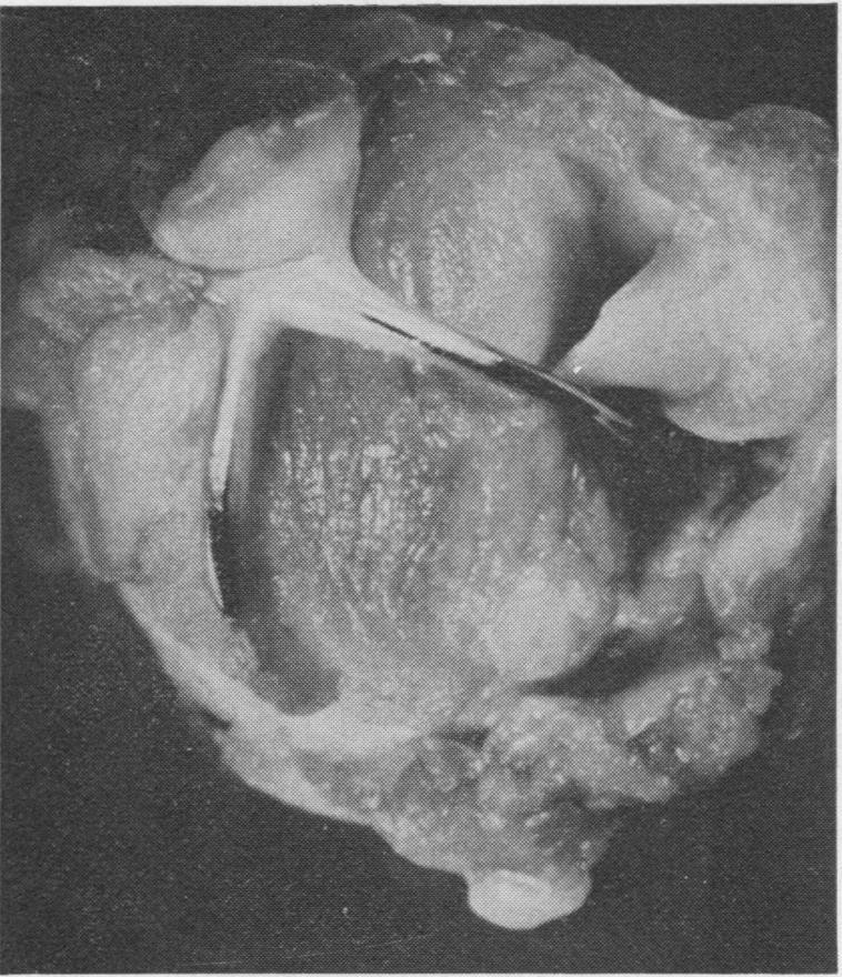 https://cdn.ncbi.nlm.nih.gov/pmc/blobs/713b/472717/8b847946d99a/thorax00111-0079-a.jpg