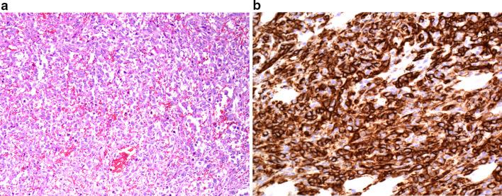 https://cdn.ncbi.nlm.nih.gov/pmc/blobs/713b/8684573/d9690a12eb6c/13244_2021_1129_Fig1_HTML.jpg