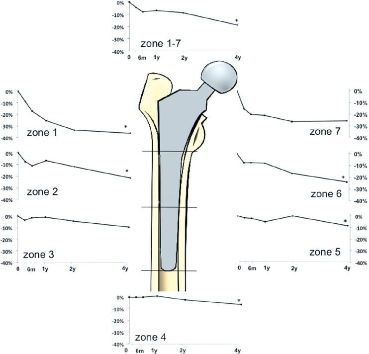 https://cdn.ncbi.nlm.nih.gov/pmc/blobs/713c/4105771/c6e9f1b38788/ORT-85-396-g002.jpg