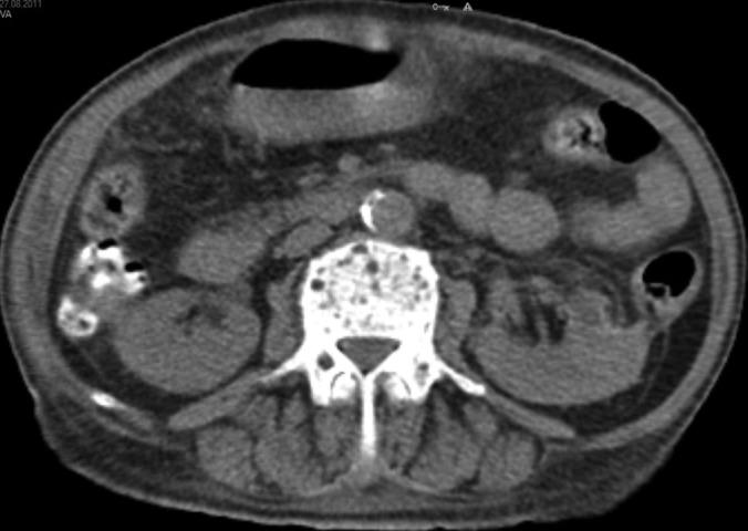 https://cdn.ncbi.nlm.nih.gov/pmc/blobs/713e/4035644/7e5b600b0444/jls0041331650004.jpg