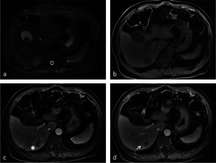 https://cdn.ncbi.nlm.nih.gov/pmc/blobs/7144/10667410/9bbfddcd0b13/330_2023_9873_Fig4_HTML.jpg