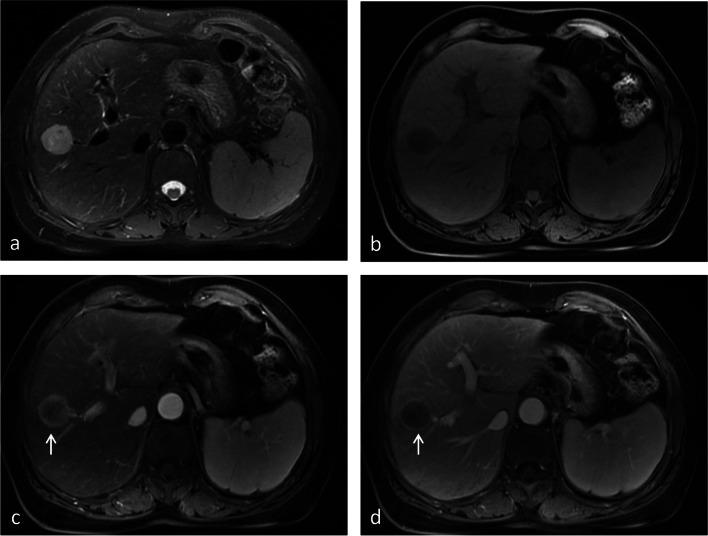 https://cdn.ncbi.nlm.nih.gov/pmc/blobs/7144/10667410/f3242b53dbce/330_2023_9873_Fig5_HTML.jpg