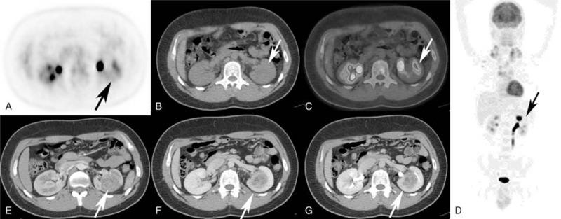 https://cdn.ncbi.nlm.nih.gov/pmc/blobs/7148/4602442/7d39fb556a9d/medi-93-e50-g005.jpg