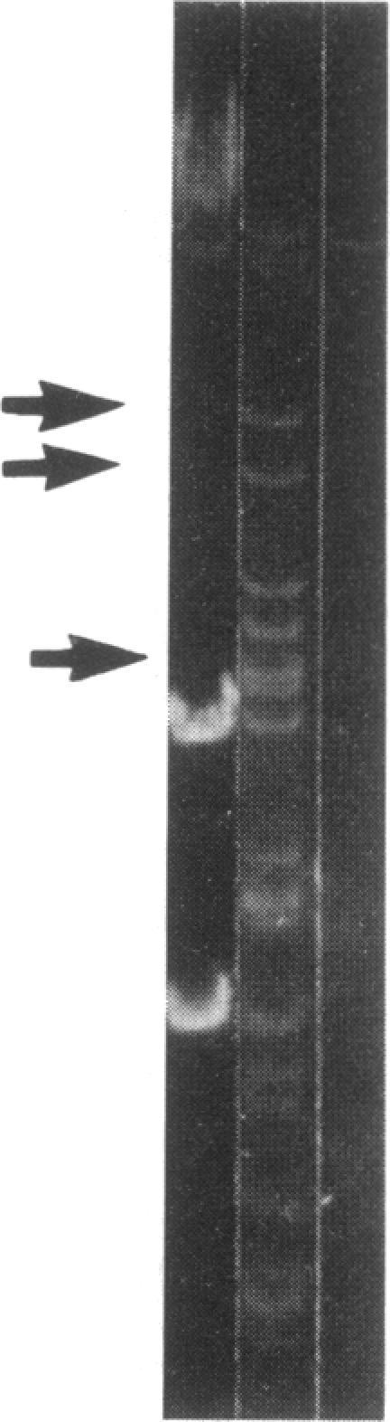 https://cdn.ncbi.nlm.nih.gov/pmc/blobs/714b/207836/24bb8ffac9fd/jbacter00098-0272-a.jpg