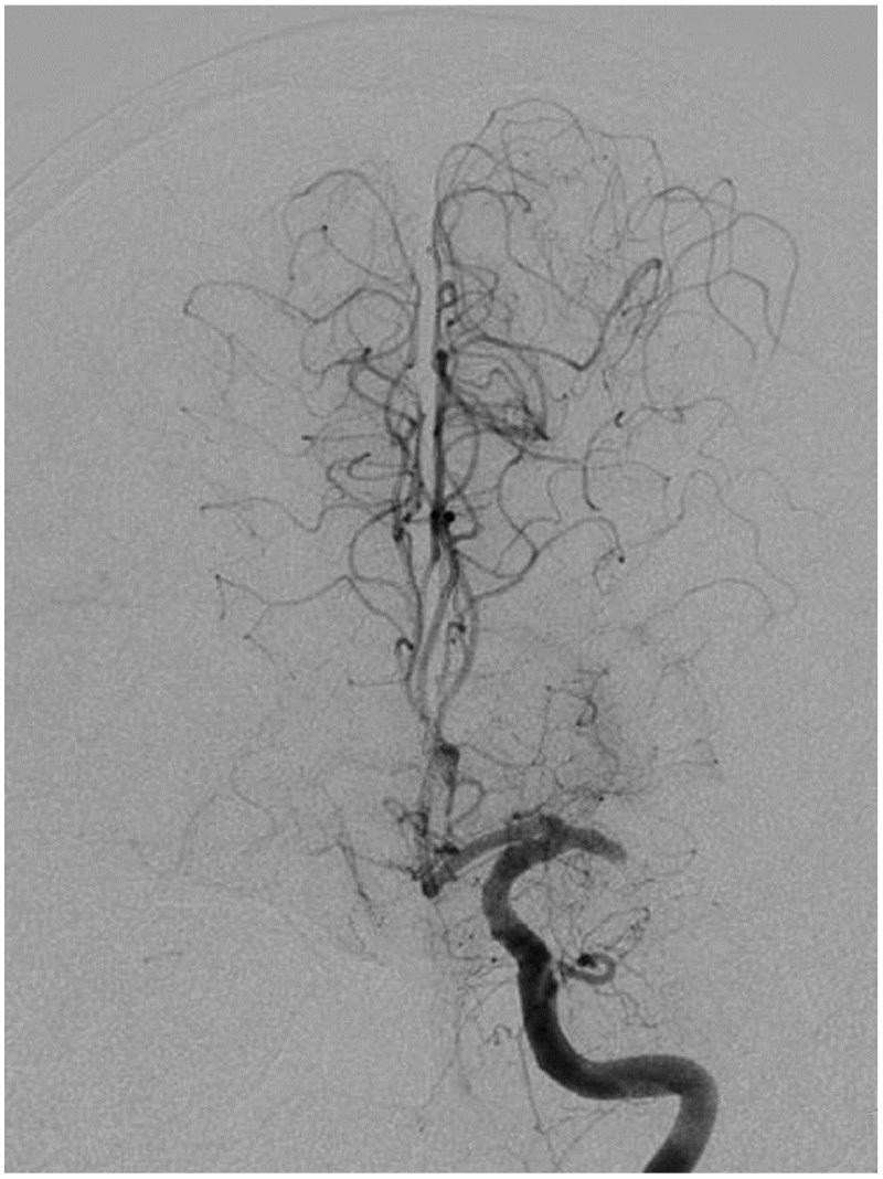 https://cdn.ncbi.nlm.nih.gov/pmc/blobs/7155/4995271/6be19df456ba/2186-3326-78-0255-g009.jpg