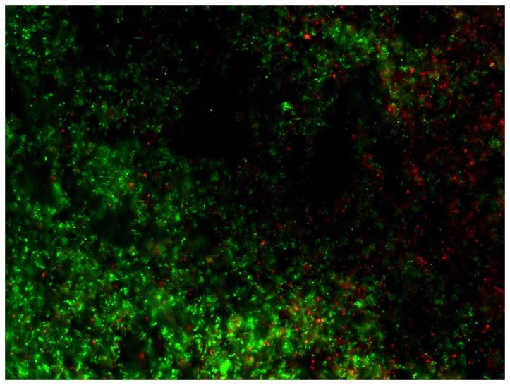 https://cdn.ncbi.nlm.nih.gov/pmc/blobs/7156/3815119/42a6c4d389ac/pone.0079119.g003.jpg