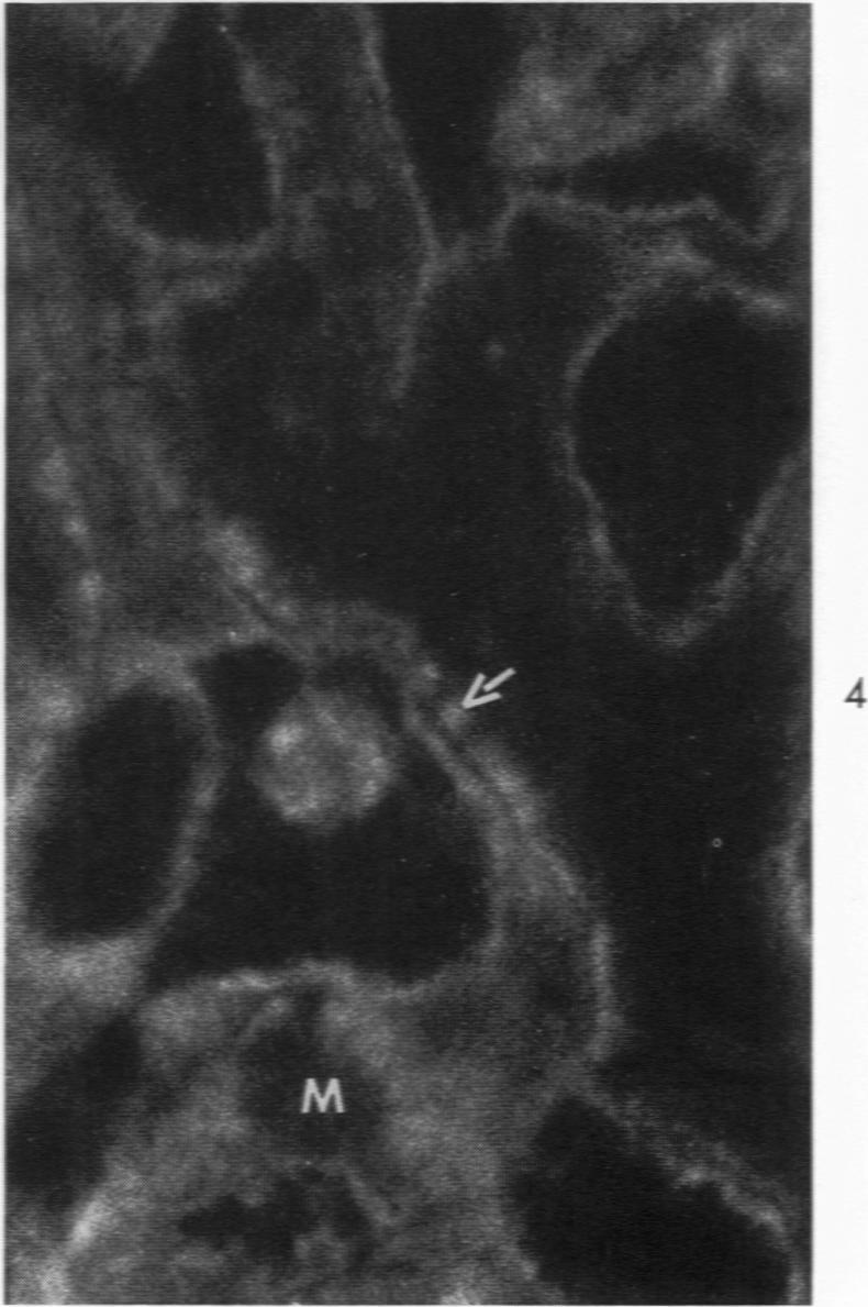 https://cdn.ncbi.nlm.nih.gov/pmc/blobs/715a/2013357/340aac98f629/amjpathol00428-0074-d.jpg