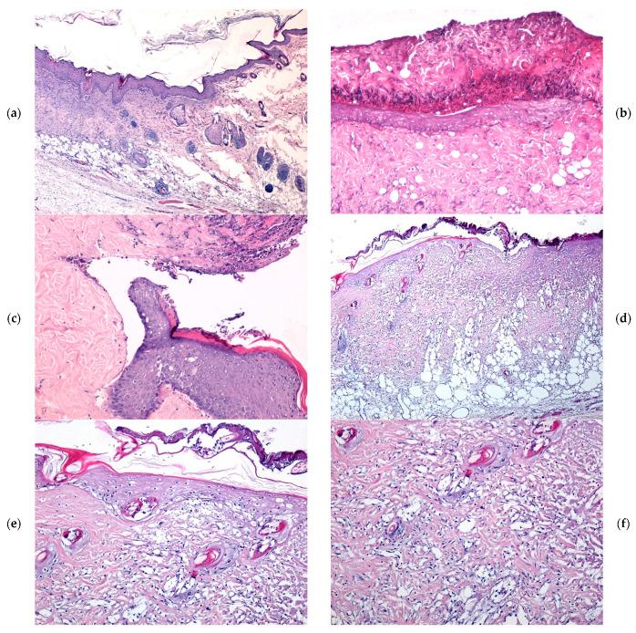 https://cdn.ncbi.nlm.nih.gov/pmc/blobs/715d/12191814/5930a51066db/gels-11-00427-g005.jpg