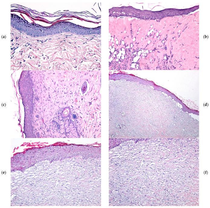 https://cdn.ncbi.nlm.nih.gov/pmc/blobs/715d/12191814/aed8e71f9a2d/gels-11-00427-g006.jpg