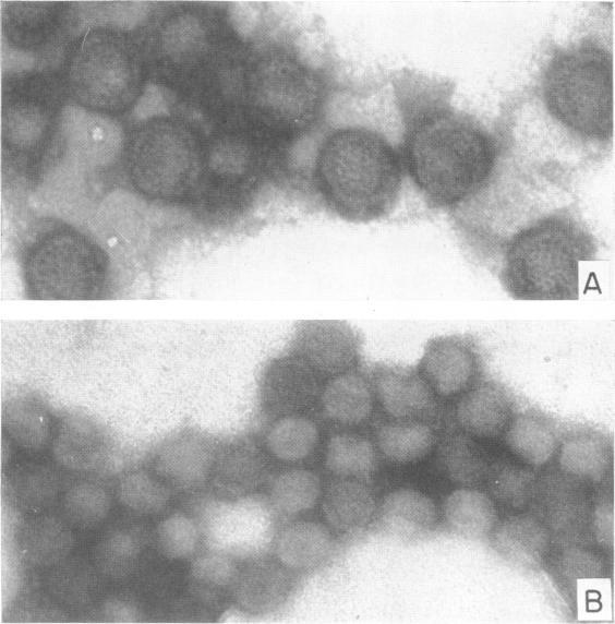 https://cdn.ncbi.nlm.nih.gov/pmc/blobs/715e/375475/829306017815/jvirol00323-0124-a.jpg