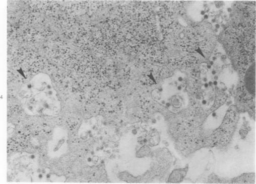 https://cdn.ncbi.nlm.nih.gov/pmc/blobs/7164/2032456/5962fac33f8c/amjpathol00447-0170-a.jpg