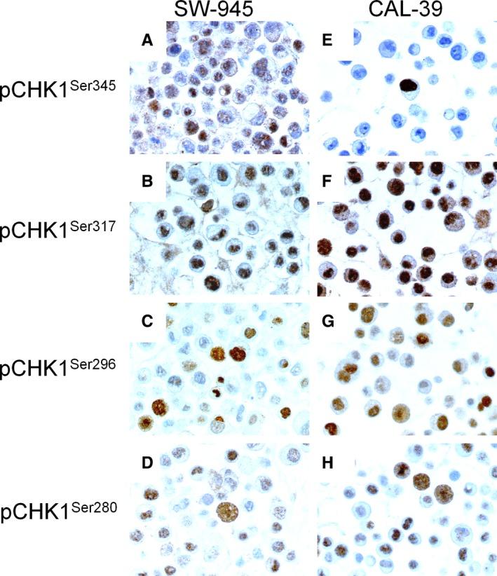 https://cdn.ncbi.nlm.nih.gov/pmc/blobs/7164/6089182/ca4ec6129bdb/CAM4-7-3955-g002.jpg