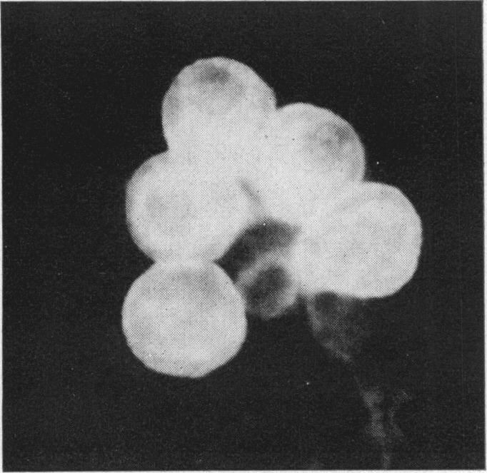 https://cdn.ncbi.nlm.nih.gov/pmc/blobs/7166/1411019/18d33abee993/gut00501-0037-b.jpg