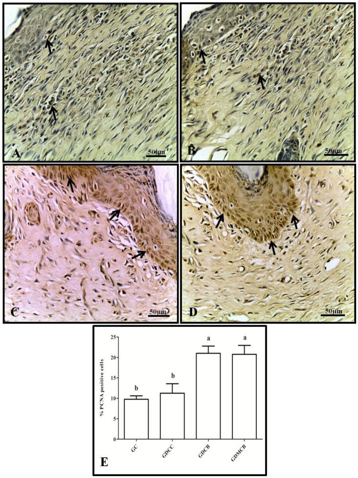 https://cdn.ncbi.nlm.nih.gov/pmc/blobs/7168/11435683/e060d31276e8/polymers-16-02611-g004.jpg