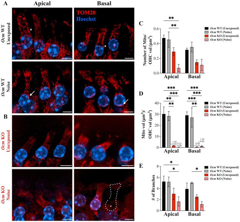 https://cdn.ncbi.nlm.nih.gov/pmc/blobs/7172/11537894/0395eaece81f/fneur-15-1435749-g006.jpg