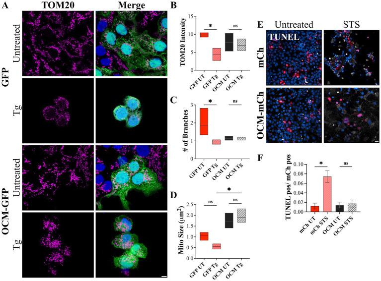 https://cdn.ncbi.nlm.nih.gov/pmc/blobs/7172/11537894/8bfc407b686b/fneur-15-1435749-g007.jpg