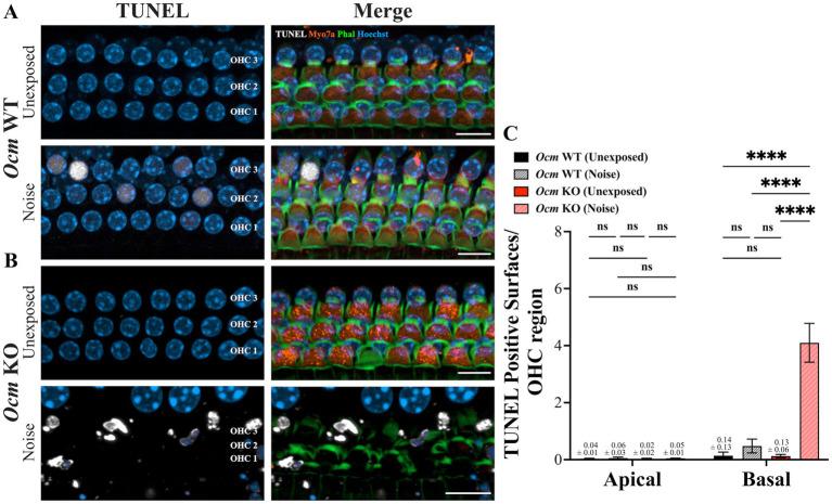 https://cdn.ncbi.nlm.nih.gov/pmc/blobs/7172/11537894/91aa346b05c5/fneur-15-1435749-g004.jpg