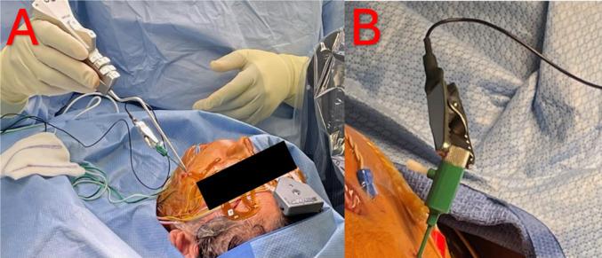 https://cdn.ncbi.nlm.nih.gov/pmc/blobs/7172/12141406/f4c1a48aec4b/701_2025_6575_Fig3_HTML.jpg
