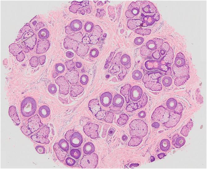 https://cdn.ncbi.nlm.nih.gov/pmc/blobs/7174/11962920/37a666e8bbd8/gr5.jpg