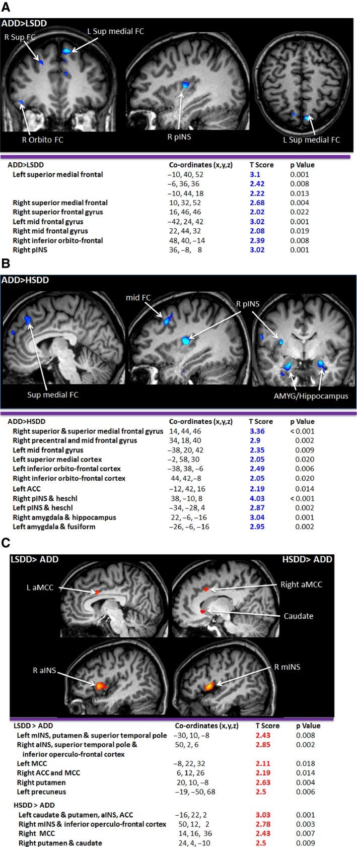 https://cdn.ncbi.nlm.nih.gov/pmc/blobs/7176/4879512/773583a52dae/NMO-28-900-g004.jpg