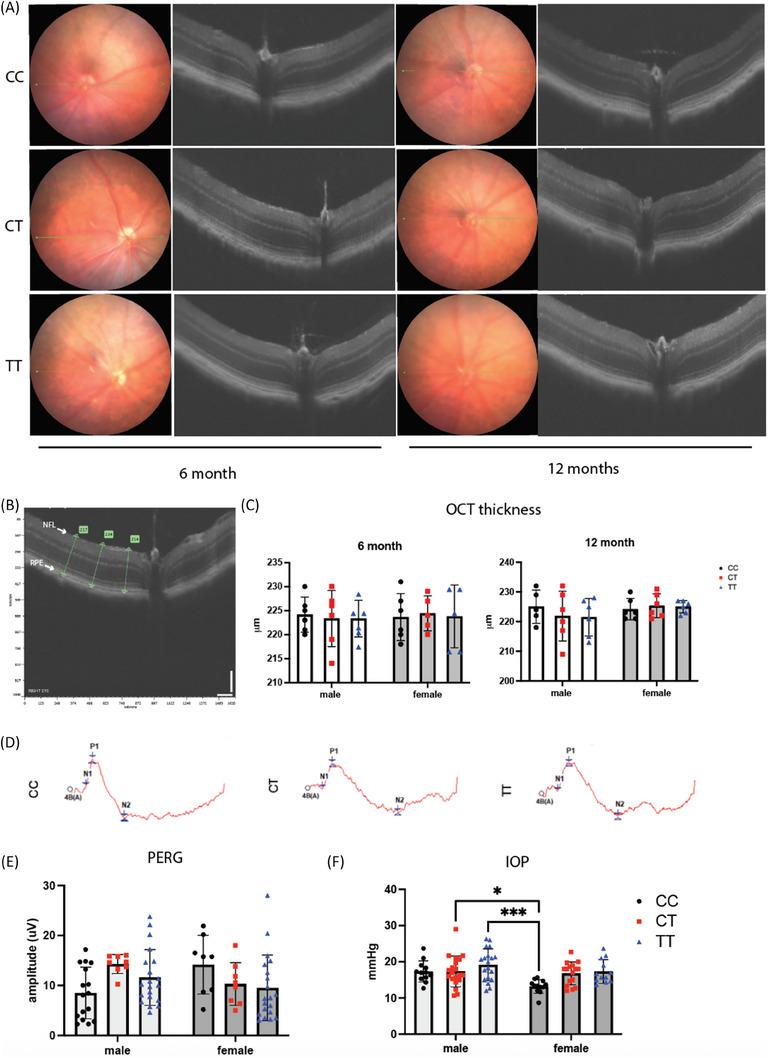 https://cdn.ncbi.nlm.nih.gov/pmc/blobs/717a/12311620/9c46280f7291/ALZ-21-e70501-g006.jpg