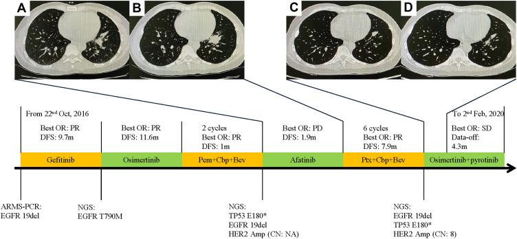 https://cdn.ncbi.nlm.nih.gov/pmc/blobs/717e/8609241/25184a5a6fad/OTT-14-5297-g0004.jpg