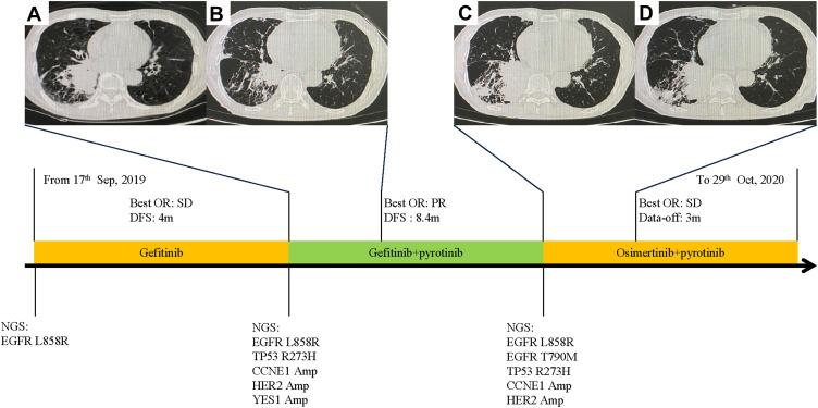https://cdn.ncbi.nlm.nih.gov/pmc/blobs/717e/8609241/6f0993ae6d54/OTT-14-5297-g0005.jpg