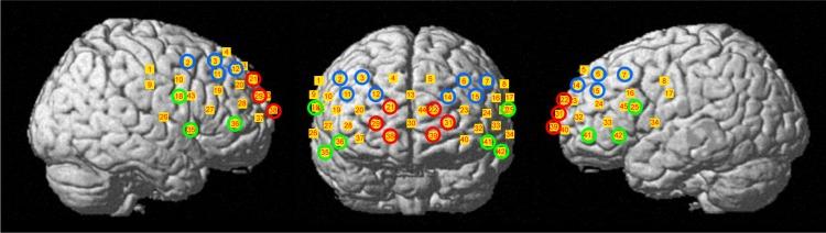 https://cdn.ncbi.nlm.nih.gov/pmc/blobs/7180/5746069/ecc73c37903b/ndt-14-061Fig3.jpg