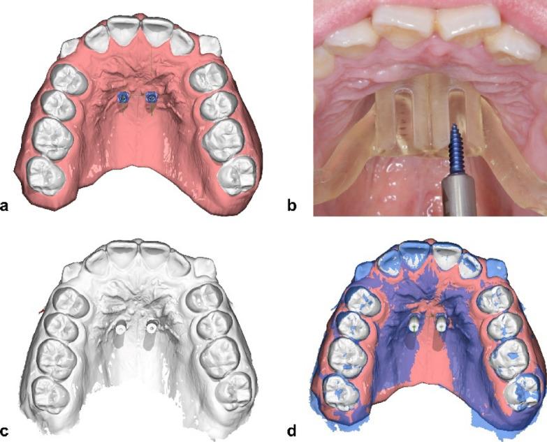 https://cdn.ncbi.nlm.nih.gov/pmc/blobs/7181/12394681/ed7827c11870/41598_2025_12116_Fig4_HTML.jpg