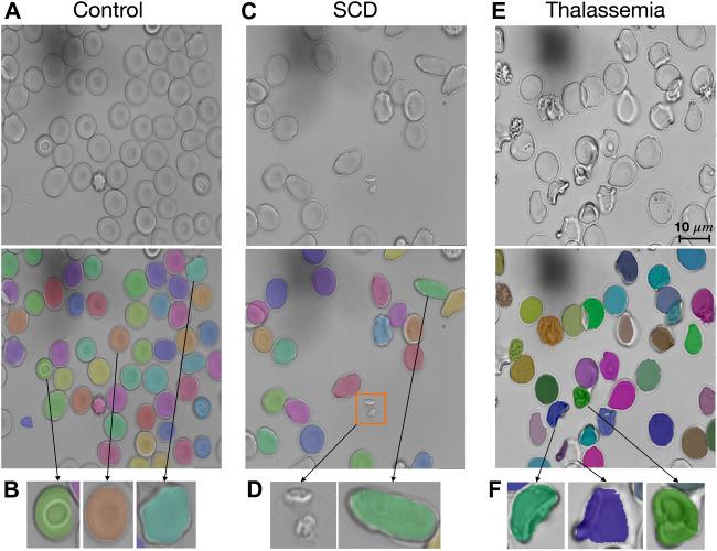 https://cdn.ncbi.nlm.nih.gov/pmc/blobs/7186/10250619/84dd132e978f/fphys-14-1058720-g003.jpg