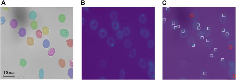 https://cdn.ncbi.nlm.nih.gov/pmc/blobs/7186/10250619/c16b29872442/fphys-14-1058720-g005.jpg