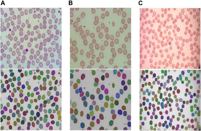 https://cdn.ncbi.nlm.nih.gov/pmc/blobs/7186/10250619/d10dfa822fda/fphys-14-1058720-g004.jpg