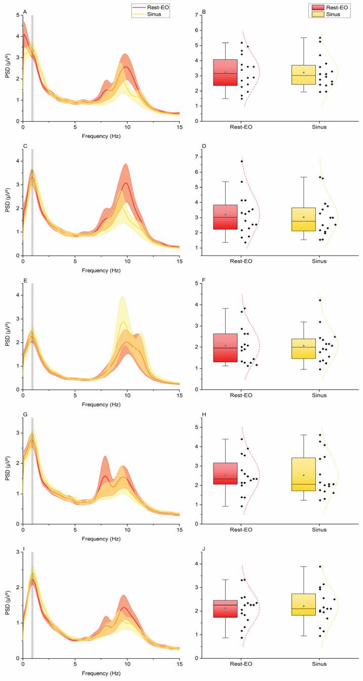 https://cdn.ncbi.nlm.nih.gov/pmc/blobs/718e/12109835/efef098d0d4c/brainsci-15-00440-g005.jpg