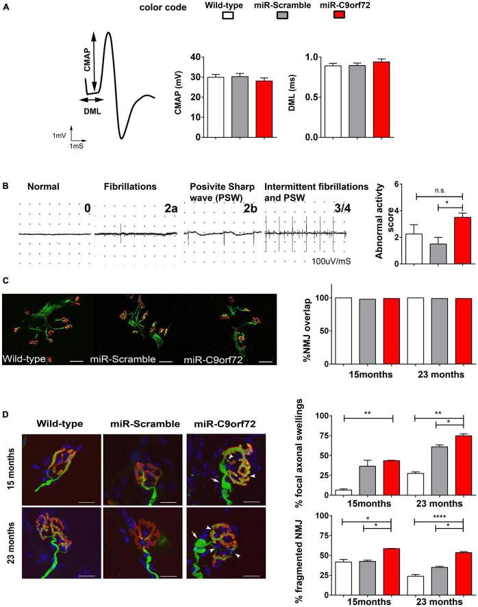 https://cdn.ncbi.nlm.nih.gov/pmc/blobs/7192/10149765/1fd997ba6969/fncel-17-1155929-g006.jpg