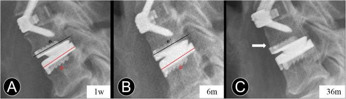 https://cdn.ncbi.nlm.nih.gov/pmc/blobs/719d/7545925/d30cf64466f1/12891_2020_3664_Fig2_HTML.jpg