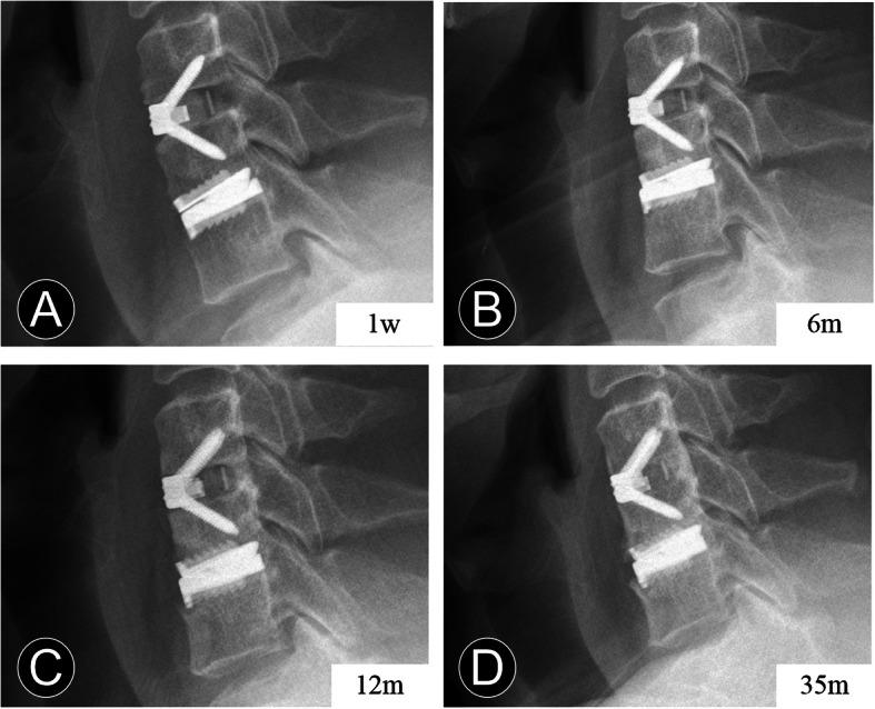 https://cdn.ncbi.nlm.nih.gov/pmc/blobs/719d/7545925/e6876277e3a3/12891_2020_3664_Fig4_HTML.jpg