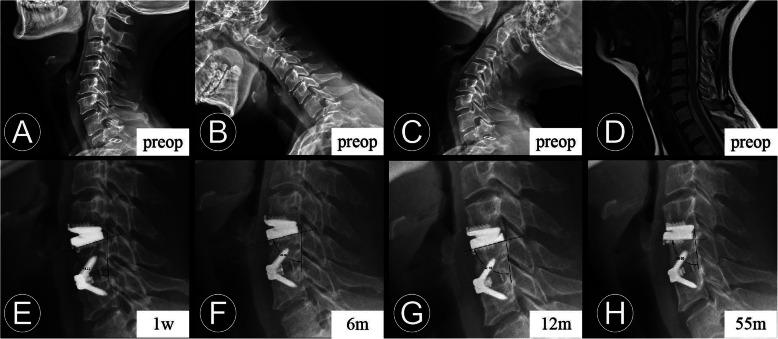 https://cdn.ncbi.nlm.nih.gov/pmc/blobs/719d/7545925/e8f459e2d0ef/12891_2020_3664_Fig1_HTML.jpg