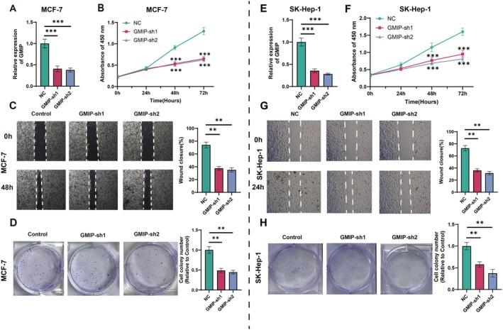 https://cdn.ncbi.nlm.nih.gov/pmc/blobs/71a0/12021672/6e9b53d06f4b/JCMM-29-e70476-g006.jpg