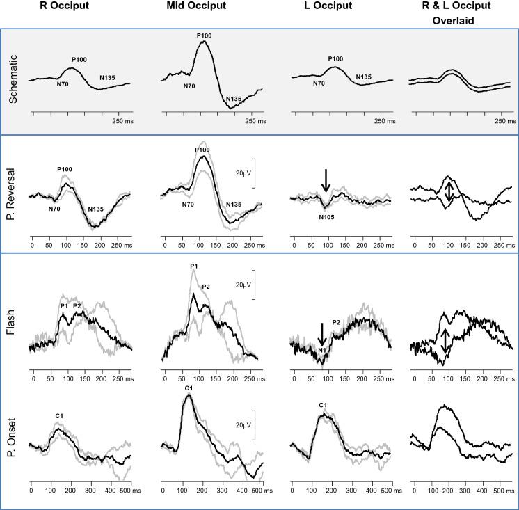 https://cdn.ncbi.nlm.nih.gov/pmc/blobs/71a2/7943516/1b45724aa289/10633_2020_9788_Fig4_HTML.jpg