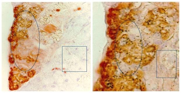 https://cdn.ncbi.nlm.nih.gov/pmc/blobs/71a5/2931354/70eef1c7fda0/jcav01p0006g06.jpg