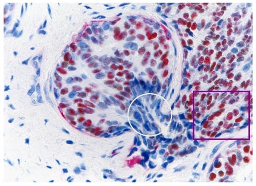 https://cdn.ncbi.nlm.nih.gov/pmc/blobs/71a5/2931354/8989ec567571/jcav01p0006g10.jpg