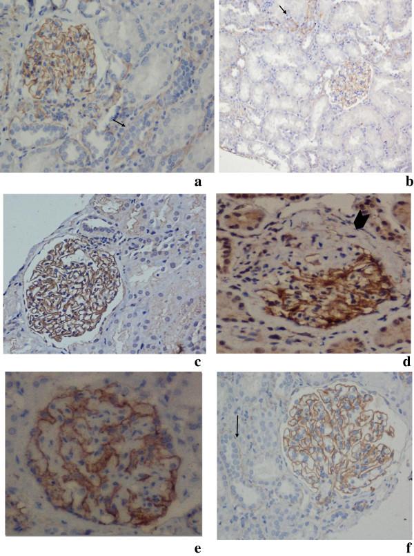 https://cdn.ncbi.nlm.nih.gov/pmc/blobs/71a5/3996081/a4677c979160/1746-1596-9-40-1.jpg