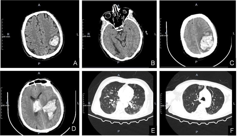 https://cdn.ncbi.nlm.nih.gov/pmc/blobs/71a7/12018222/b32332e42290/fonc-15-1549261-g002.jpg